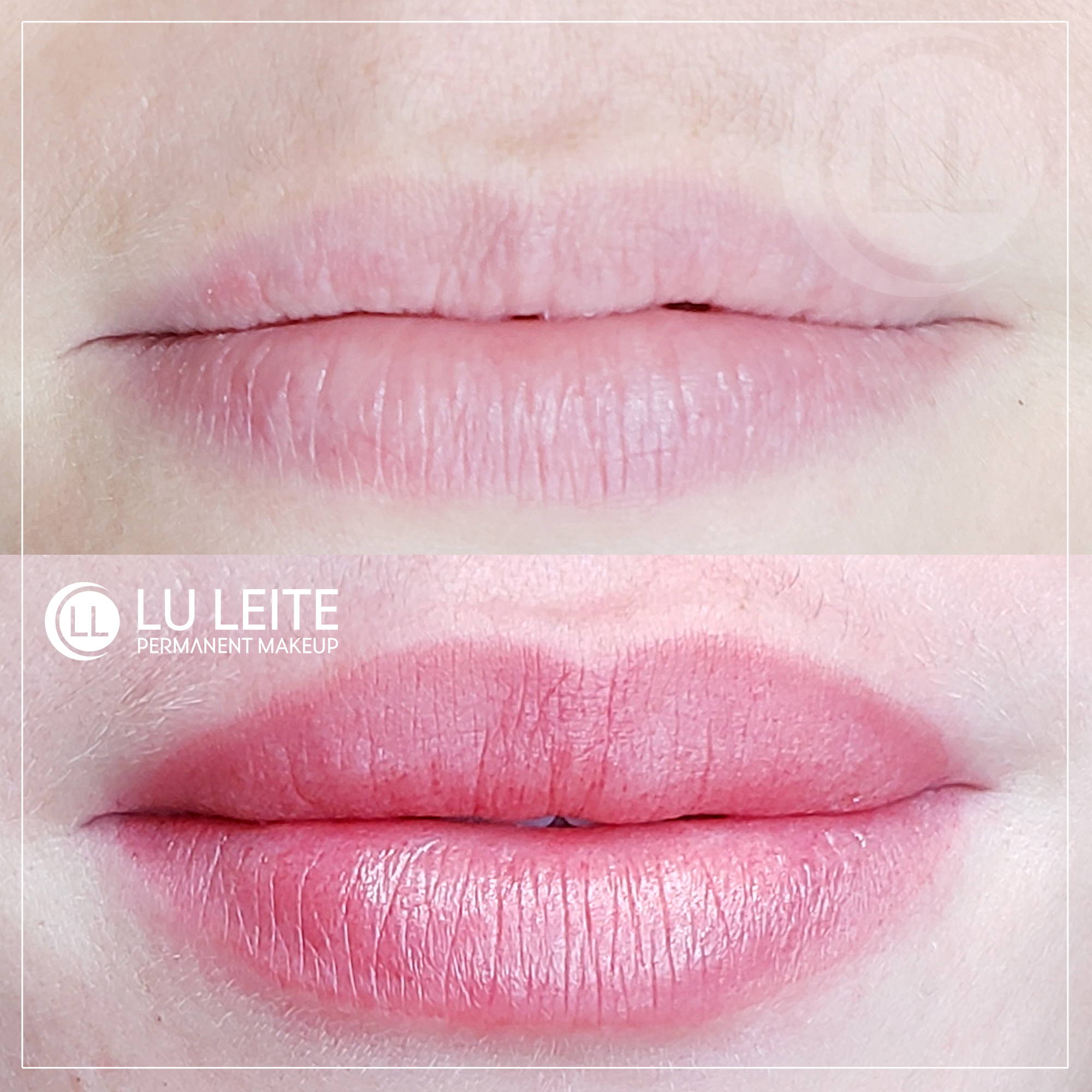 Micropigmenta&ccedil;&atilde;o labial