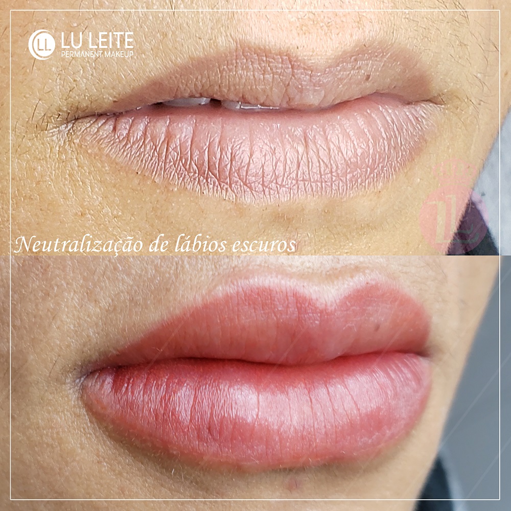 Micropigmenta&ccedil;&atilde;o labial