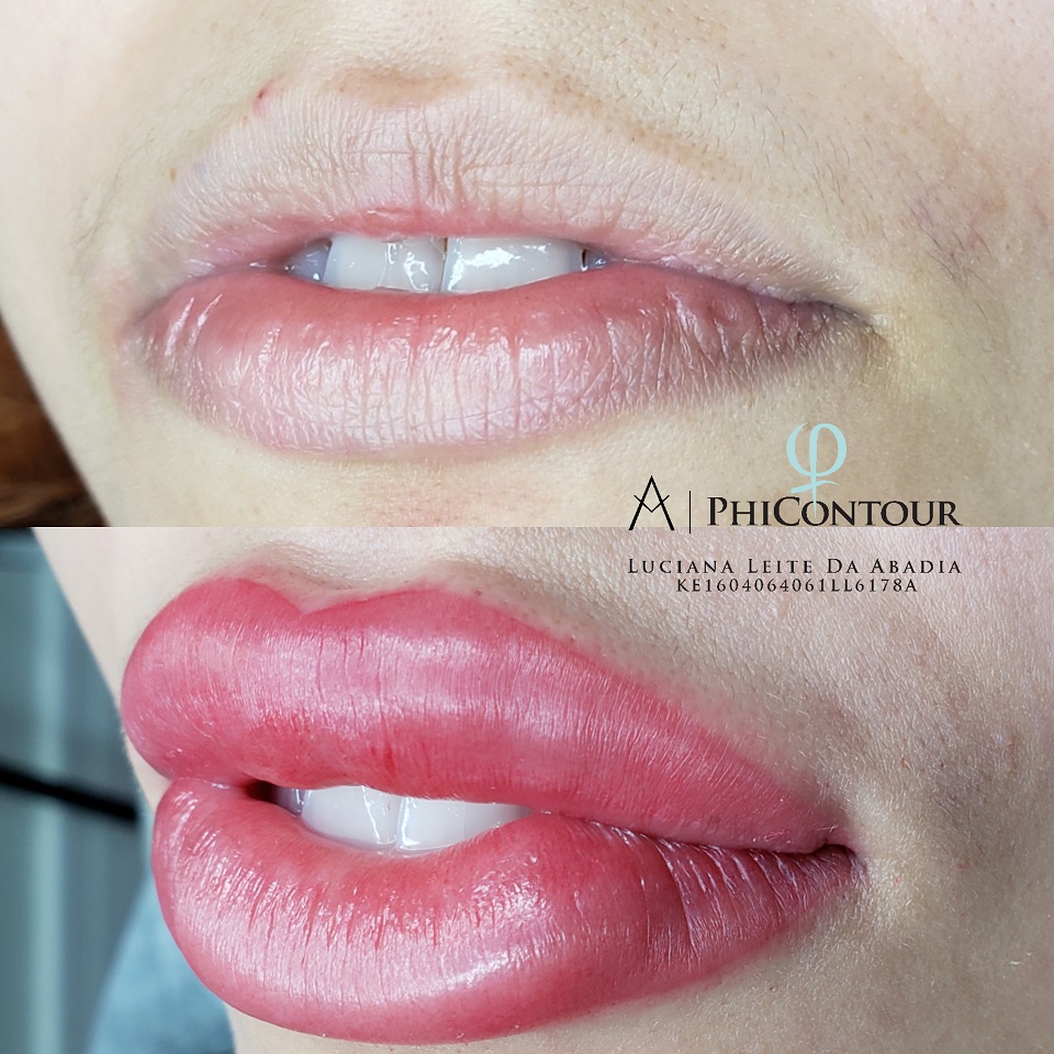 Micropigmenta&ccedil;&atilde;o labial