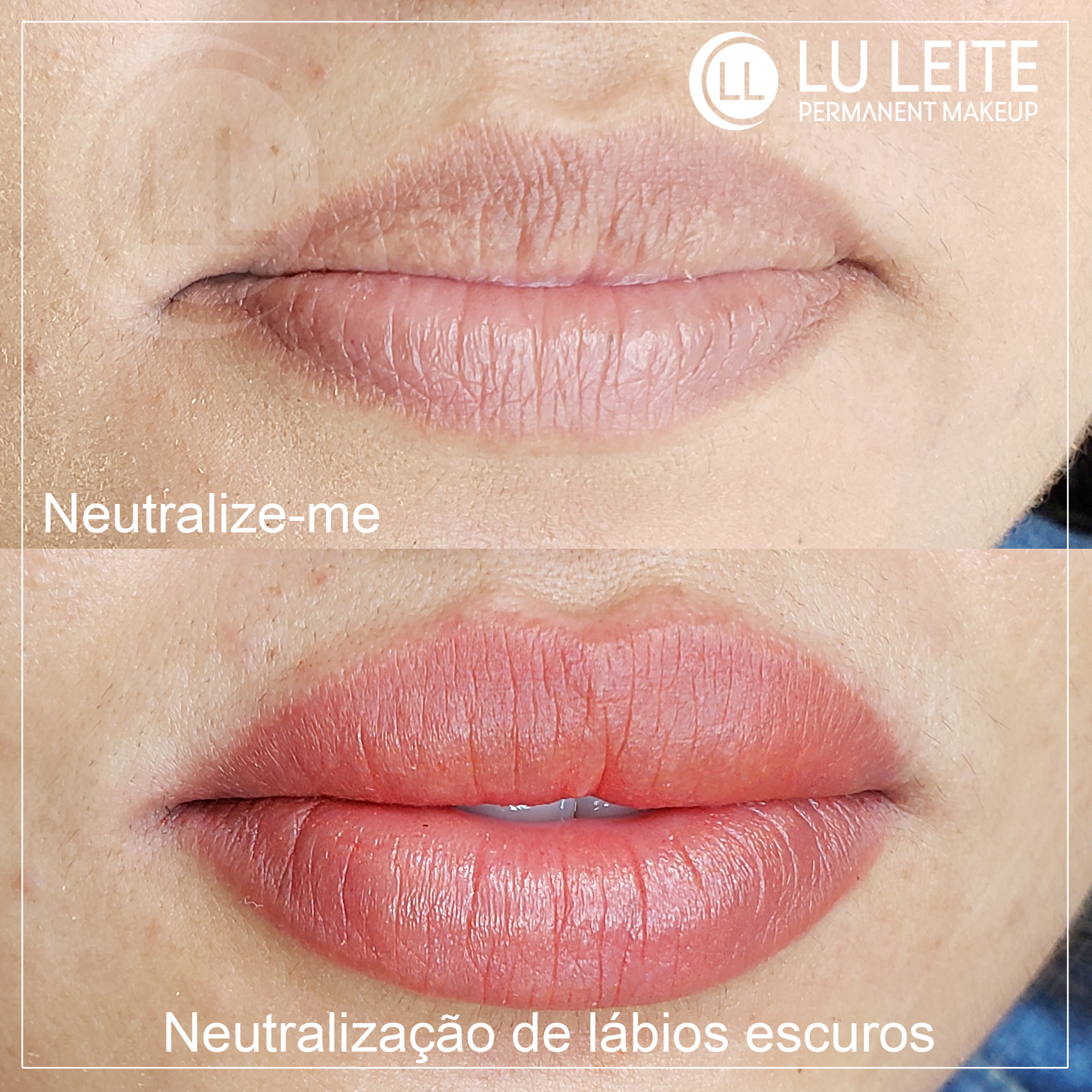 Neutraliza&ccedil;&atilde;o labial