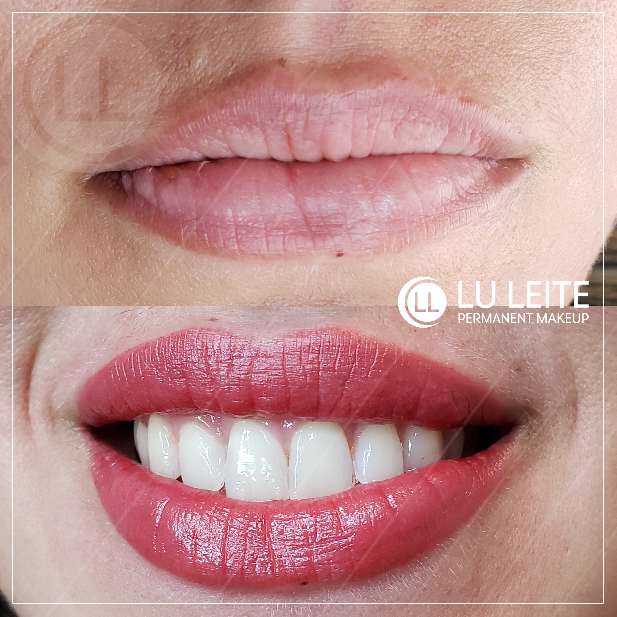 Micropigmenta&ccedil;&atilde;o labial