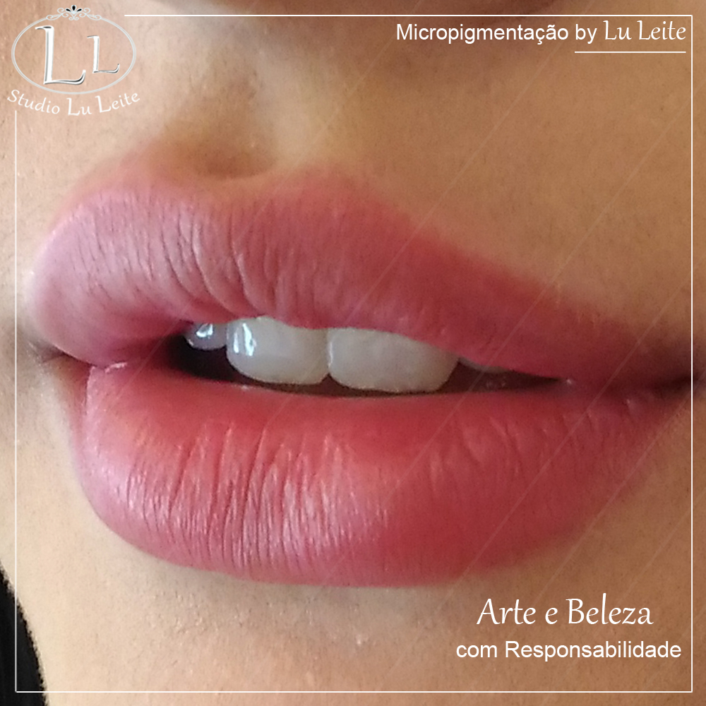 Micropigmenta&ccedil;&atilde;o labial