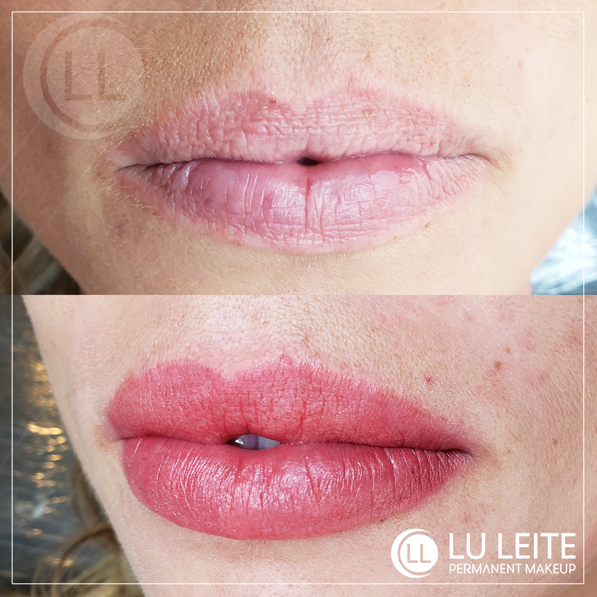 Micropigmenta&ccedil;&atilde;o labial