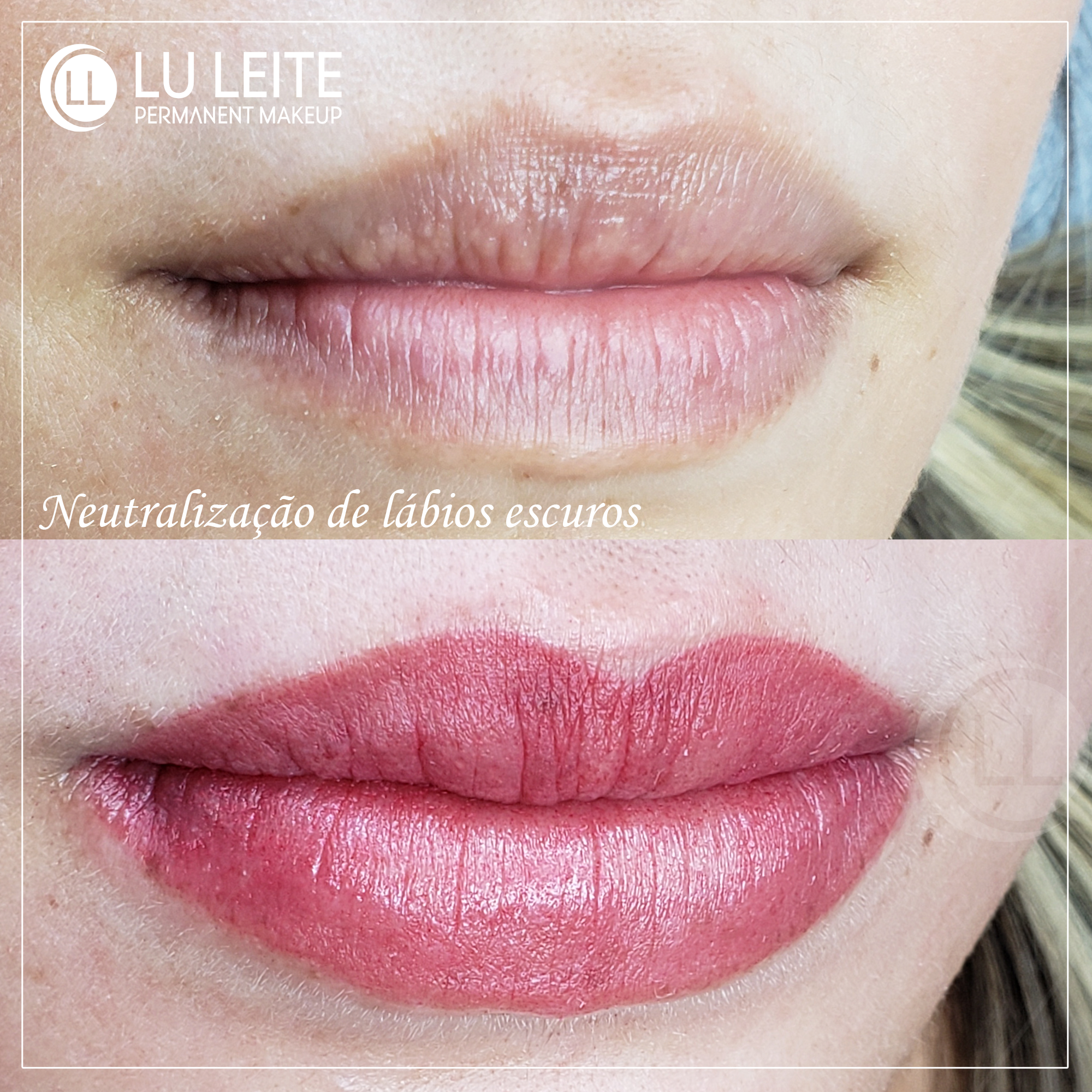 Micropigmenta&ccedil;&atilde;o labial