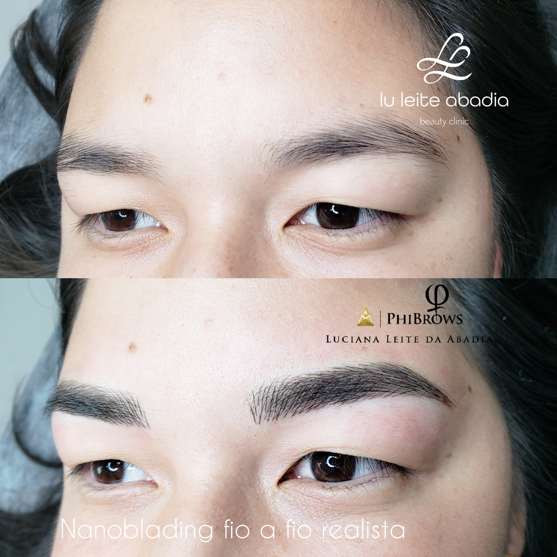 Micropigmenta&ccedil;&atilde;o para orientais