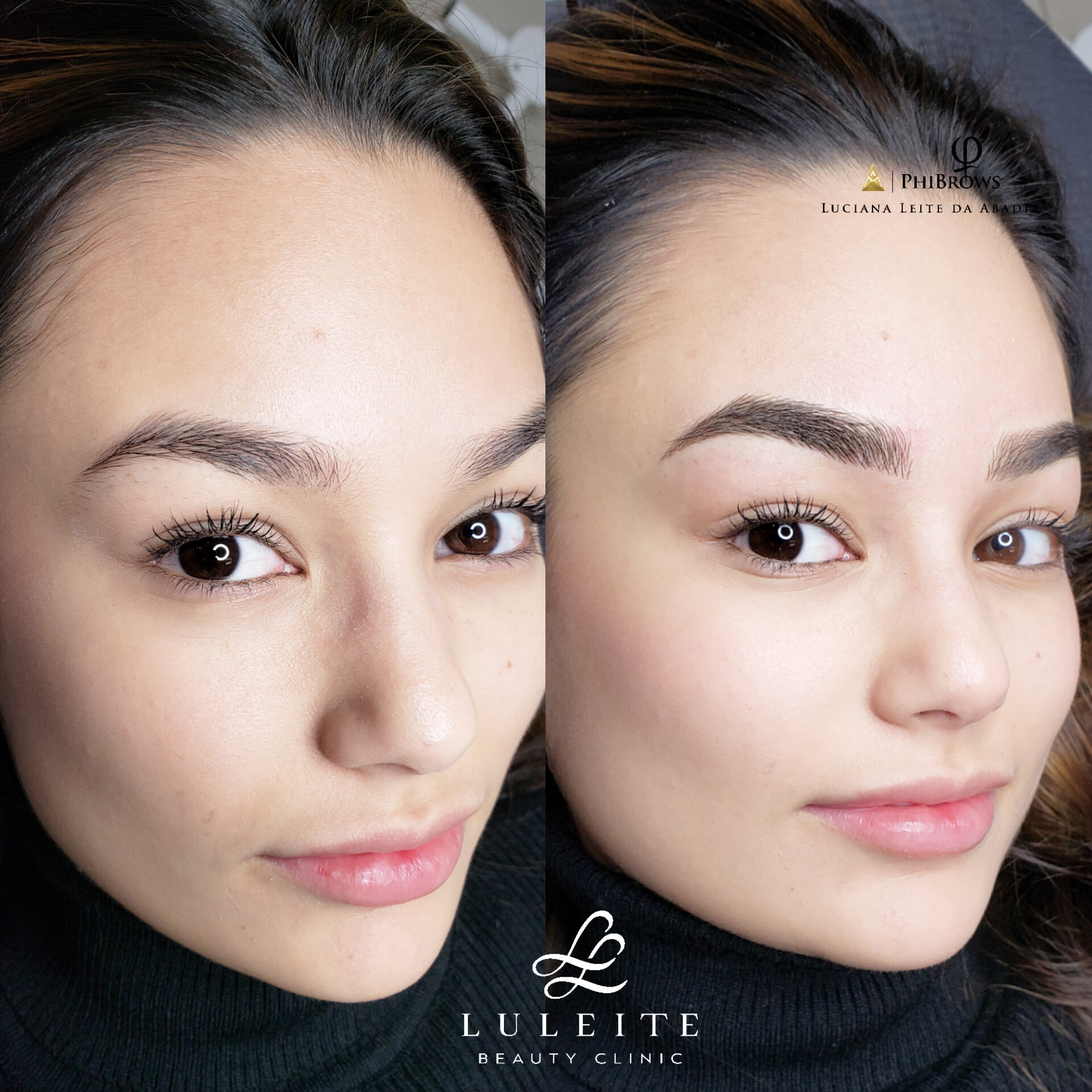 Micropigmenta&ccedil;&atilde;o para orientais